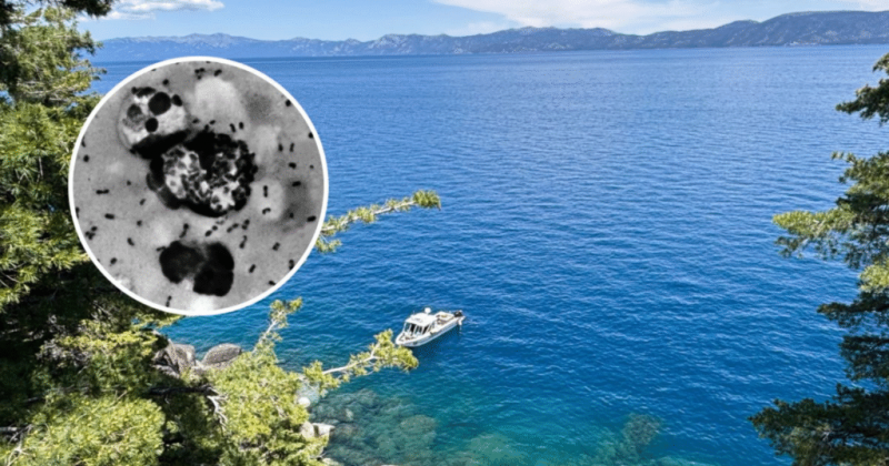 California resident tested positive for plague