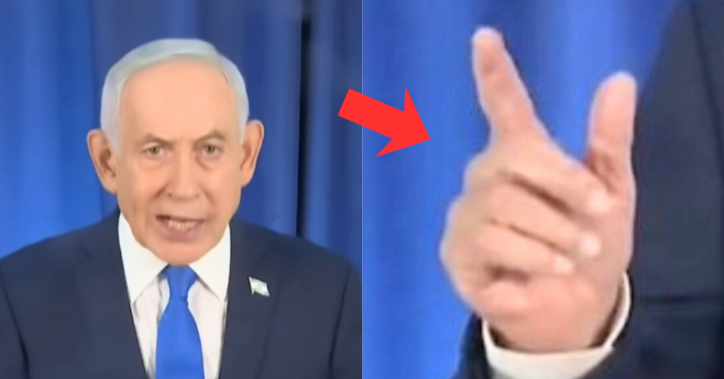 Rumors About Odd Netanyahu Hand Detail Addressed
