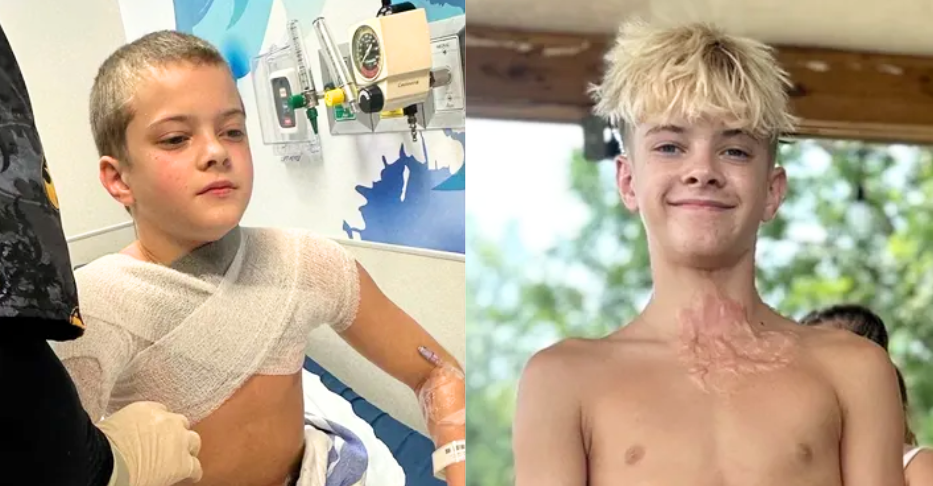 Teen Says ‘I Thought I was Going to Die’ After Viral Trend Goes Horribly Wrong